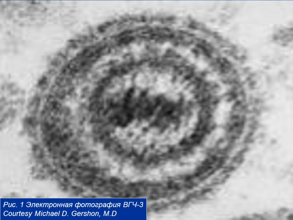 3 Рис. 1 Электронная фотография ВГЧ-3 Courtesy Michael D. Gershon, M.D